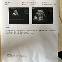 今天刚去做了B超还有唐筛，不知道宝妈们会不会看男宝女宝？问医生了医生没告。