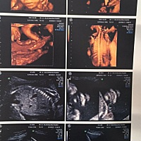 有没有会看的，现在得开始想好名字了，最近老是看到一些孩子出生后有些缺陷，已经没有开始那样期待宝宝...