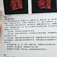 会看的帮忙看看是男孩女孩