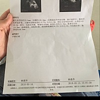 请问下各位宝妈这正常吗？医生说胎心有点高