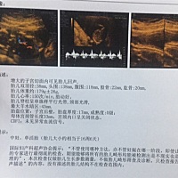 有谁可以从彩超单可以看出是女孩还是男孩吗！我挺好奇的～