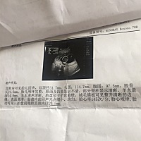 16周的B超！好奇有会看的知道男宝女宝的吗？🎉🎉