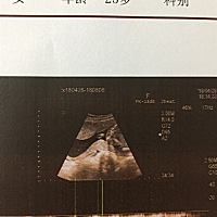 宝妈们帮忙看看这像什么呀！