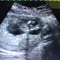 我去做b超人家说我的是男的，怎么我看起来像肚胫呢，有哪位大神会看吗？