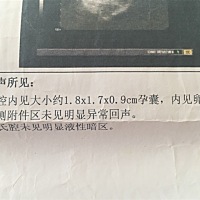 图一是孕六周做的B超孕囊，图二是孕九周四天做的检查。这孕囊是男孩女孩。？