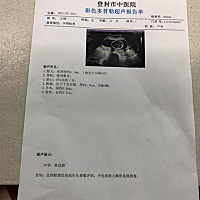 18周了，还是七上八下的，一会像男孩，一会像闺女，一会看不清，真熬煎人啊。我想要闺女啊，好事成双。...