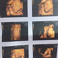 24周的四维彩超！大家帮我看看是男孩女孩！太好奇了