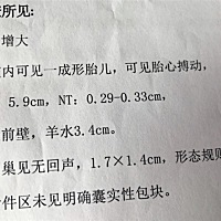 NT值偏高，绒穿结果出来了！12周3天NT检查，上床以后怎么都看不清楚，让我去楼梯爬楼20分钟再过来看，20...