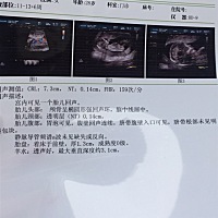 大家帮忙看看是男是女，想个女儿