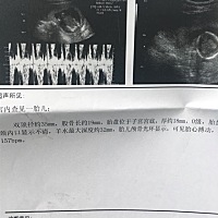 是男是女？求大师看看