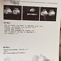 唐筛还没有做，刚做了个B超医生就说羊水少，建议我去扬州再查一下，心里立马焦急起来！是不是羊水少孩子...