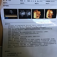 大家帮忙看下是男宝还是女宝