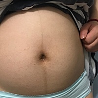 怀孕4个多月，今天发现肚皮上长了好多小红点，怎么回事啊，大家看肚子能看出来是男宝或女宝吗？