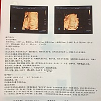 胎儿偏小，左心室出现强光斑，怎么办