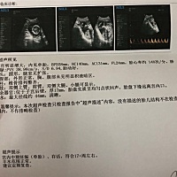 突然好奇是男生还是女生，因为想给宝宝取名字了！嘻嘻😁