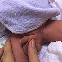 有没有宝妈知道买什么擦好得快。麻油我也试过，护臀膏也擦了！还是不见好！