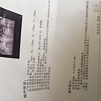 好像二胎生个女儿啊