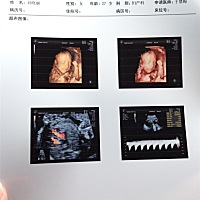 刚做的四维，有会看男女的吗？😄