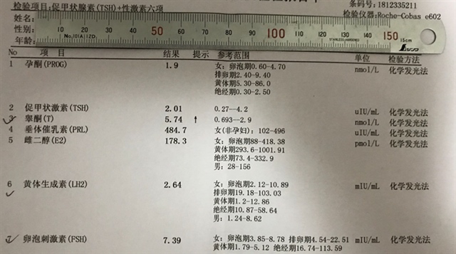 睾酮偏高…