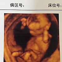 麻烦各位亲们帮忙看看，是女孩还是男孩呢