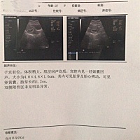 马上11周了，现在吐的越来越厉害，一天五六次，每时每刻都很恶心。食道烧的慌，现在喝水胃都疼！也没啥...