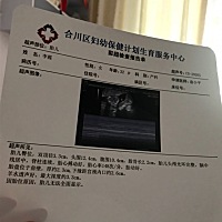 今天去产检16周胎盘前壁，胎盘低，这是二第二胎，头胎剖宫产8年了，医生说怀得太低有点危险，有懂的孕妈...