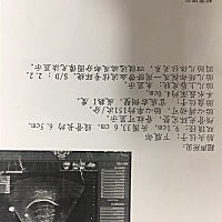 怀孕37 1双顶径9.1股骨6.5今天做B超医生说腿短大家看看这个数据正常吗？头大吗？