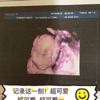 大宝女儿👧   今天找熟人B超 二宝是男孩👦。从怀孕就开始接儿女双全 终于儿女双全了。超级开心 兴奋...