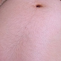 宝宝六个月了 没有妊娠线 但是感觉肚皮长了好多毛毛怎么回事呀 而且肚子也不是很大不是很显怀 顺便会看...