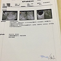 第一胎，检查发现右边有囊肿，好担心影响宝宝