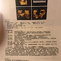 今天做的四维，医生说宝宝的心脏和十二指肠有点问题，有和我一样的情况吗，这严重吗，好担心，明天我再...