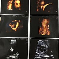 怀孕六个月，麻烦圈里姐妹帮忙看下男宝女宝？