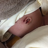 肚脐黏在尿不湿上提前掉出来了……有没有事啊？急！出生到今天有十天了！