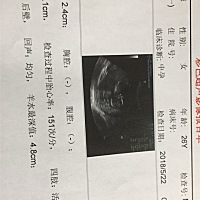 大家好，看看男宝，女宝能看出来吗