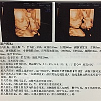 看看今天刚出炉的四维结果，大家帮忙看看是不是一个漂亮滴小公主👸，谢谢喽～