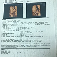 不晓得泰州哪里可以私底下查查看，实在是好奇，做完四维看到宝宝的样子更好奇了！有知情的宝妈求告知吖...