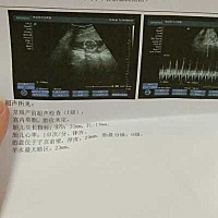 大家看看男宝女宝