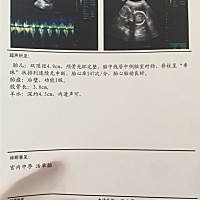 有没有会看男女的啊，这头有没有点大啊