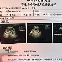 18周了，能看出男女嘛？纯属好奇