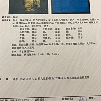 刚出炉的四维图，小家伙有点不配合小手把脸给遮住了一半边，有点小不足,还算顺利通过。妈妈们帮我看看是...