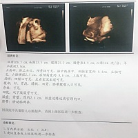 各位大神，帮忙看一下是男宝女宝啦😄ཽ