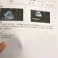 有宝妈会通过NT看男女的嘛。。。纯属好奇心。