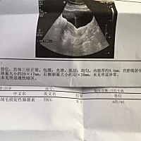 哪位好心的姐姐可以帮我解答一下。前几天我用排卵试纸（粉）跟早孕试纸（绿）测都是一条杠。今天早上测...