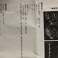 忍住没有去小医院检查 今天去大医院检查回来 对照着百度的数据 大家帮我看看是不是女孩子