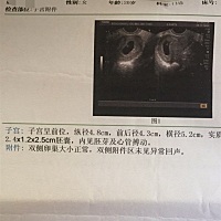 麻烦各位帮我看一下，是招商银行还是建设银行呀。比较期待 ☺️☺️