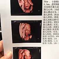第一次看到宝宝的脸，大家来看看男宝宝还是女宝宝