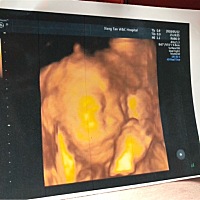 四维看男女了 有会看的宝妈？