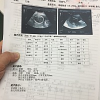 双肾盂增宽什么意思