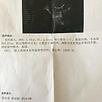 急死了！有没有跟我一样的，FL值(腿长)才2的，正常应该在3了，我该咋办，