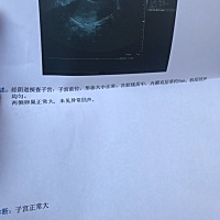 推迟20天了，去照了阴超。